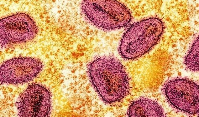 Mpox